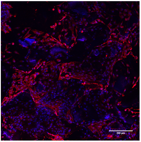 Uhlíkové kostní náhrady nové generace