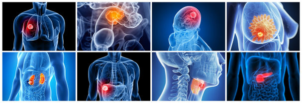 Podpora nového léčiva pro boj s rakovinou